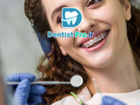 اصلاح عیوب لبخند با ترکیب ارتودنسی: راهنمای جامع زیبایی و سلامت دندان