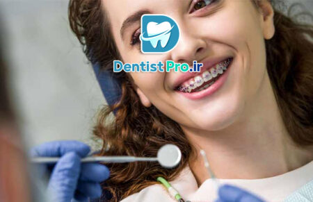 اصلاح عیوب لبخند با ترکیب ارتودنسی: راهنمای جامع زیبایی و سلامت دندان