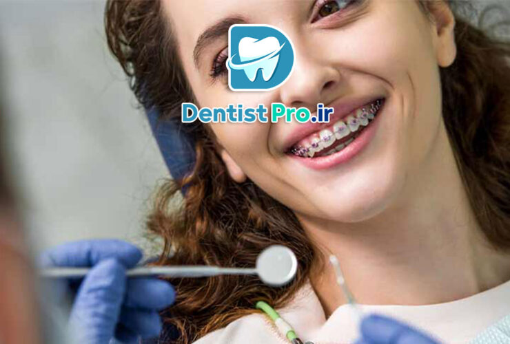 اصلاح عیوب لبخند با ترکیب ارتودنسی: راهنمای جامع زیبایی و سلامت دندان