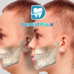اصلاح ناهنجاری های ظاهری دندان+4 موضوع مهم