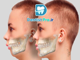 اصلاح ناهنجاری های ظاهری دندان+4 موضوع مهم