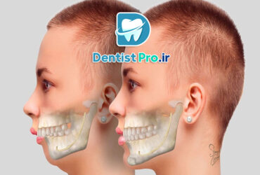 اصلاح ناهنجاری های ظاهری دندان+4 موضوع مهم