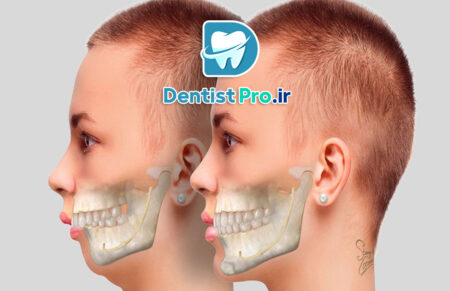 اصلاح ناهنجاری های ظاهری دندان+4 موضوع مهم