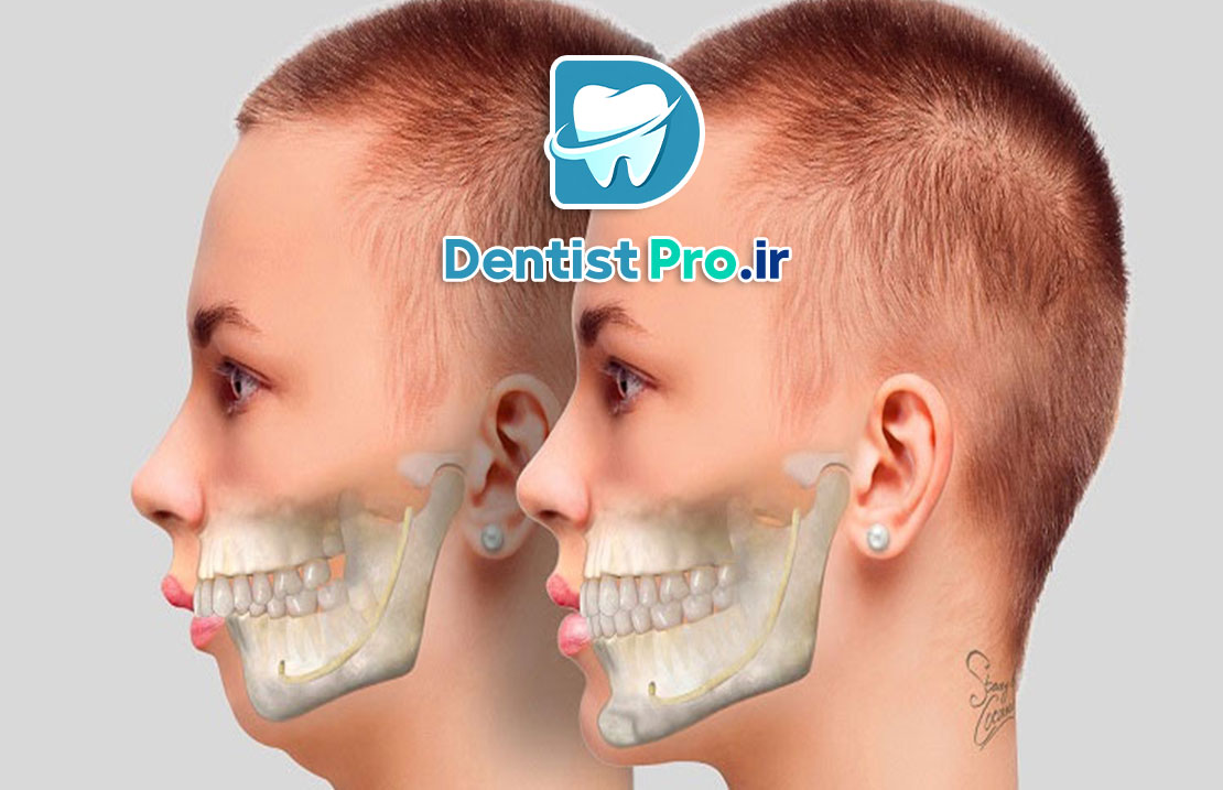 اصلاح ناهنجاری های ظاهری دندان+4 موضوع مهم 25 اصلاح ناهنجاری های ظاهری دندان+4 موضوع مهم