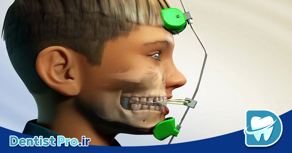 اصلاح ناهنجاری های ظاهری دندان+4 موضوع مهم 26 اصلاح ناهنجاری های ظاهری دندان+4 موضوع مهم