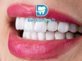 کامپوزیت نانو هیبریدی دندان: ترکیبی از زیبایی و استحکام در ترمیم‌های دندانی