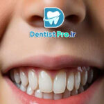 ترمیم دندان با کامپوزیت بیو سازگار کودکان: راهکاری نوین در دندانپزشکی کودکان