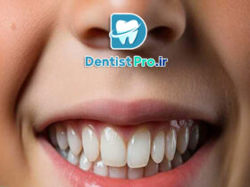 ترمیم دندان با کامپوزیت بیو سازگار کودکان: راهکاری نوین در دندانپزشکی کودکان