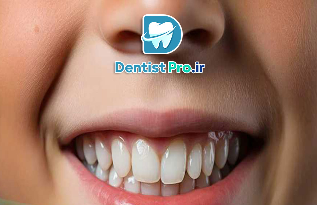 ترمیم دندان با کامپوزیت بیو سازگار کودکان: راهکاری نوین در دندانپزشکی کودکان