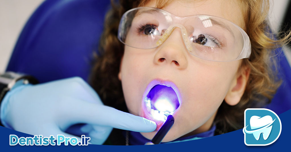 ترمیم دندان با کامپوزیت بیو سازگار کودکان: راهکاری نوین در دندانپزشکی کودکان
