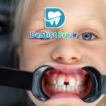 تشخیص زودهنگام ناهنجاری های فکی کودکان