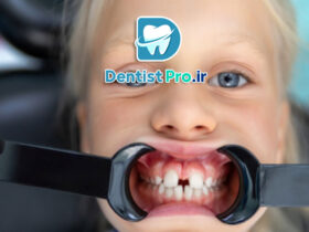 تشخیص زودهنگام ناهنجاری های فکی کودکان