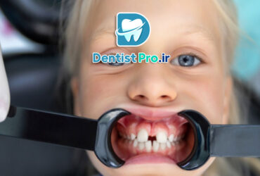 تشخیص زودهنگام ناهنجاری های فکی کودکان