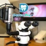 میکروسکوپ اندودنتیکس با بزرگنمایی ۳۰ برابر: ابزار انقلابی در درمان‌های اندودنتیک دقیق