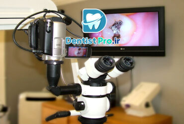 میکروسکوپ اندودنتیکس با بزرگنمایی ۳۰ برابر: ابزار انقلابی در درمان‌های اندودنتیک دقیق