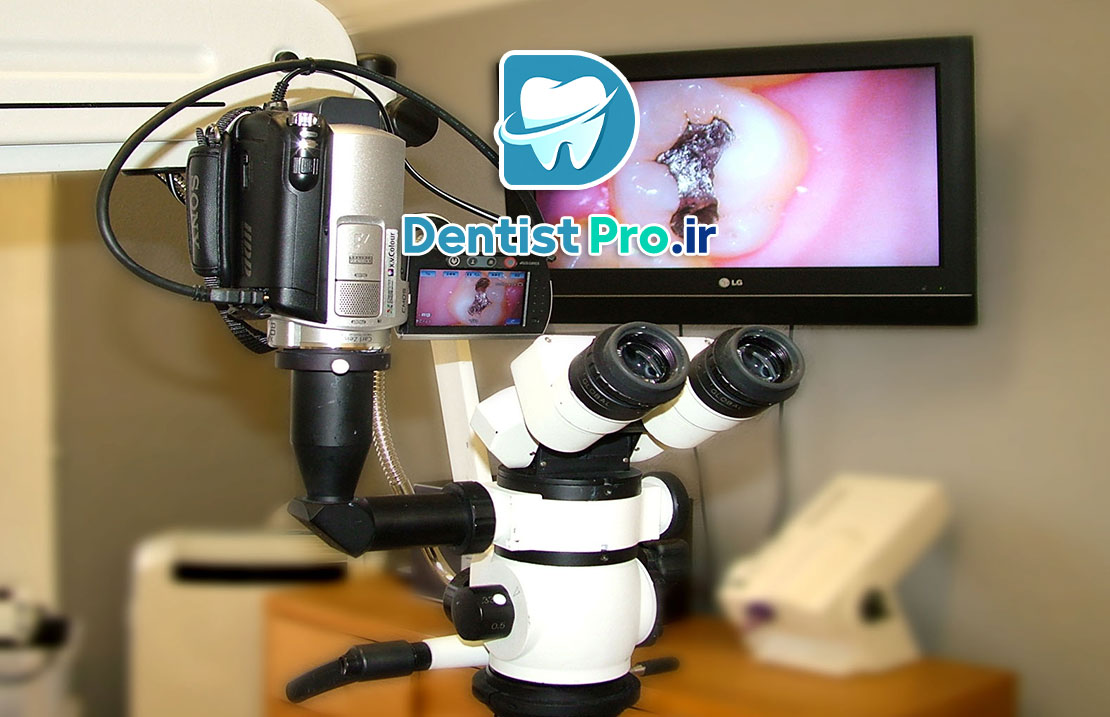 میکروسکوپ اندودنتیکس با بزرگنمایی ۳۰ برابر: ابزار انقلابی در درمان‌های اندودنتیک دقیق