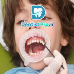 تثبیت دندان های شیری با حلقه فلزی: اهمیت، کاربردها و تکنیک‌ها