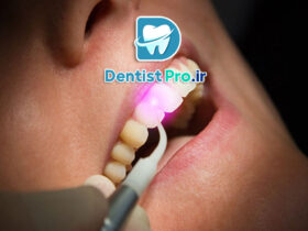 جراحی ترمیمی لثه با لیزر اربیوم فوق پیشرفته: راهکاری نوین برای درمان بیماری‌های لثه