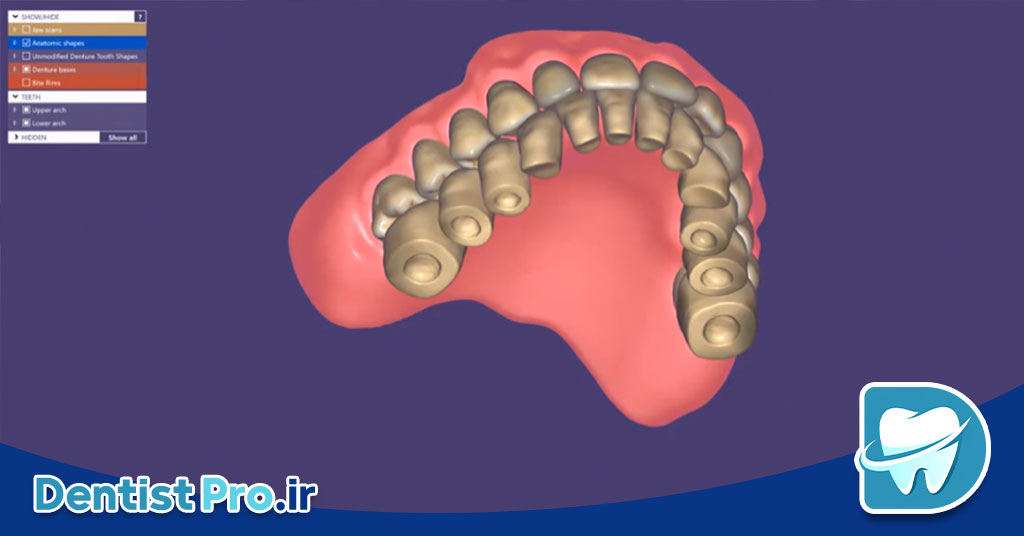 نرم افزار هوشمند آنالیز حرکت فک و دندان: تحول در دندانپزشکی دیجیتال 26 نرم افزار هوشمند آنالیز حرکت فک و دندان: تحول در دندانپزشکی دیجیتال