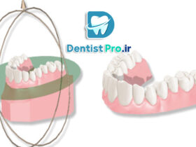 نرم افزار هوشمند آنالیز حرکت فک و دندان: تحول در دندانپزشکی دیجیتال