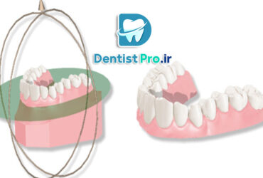 نرم افزار هوشمند آنالیز حرکت فک و دندان: تحول در دندانپزشکی دیجیتال