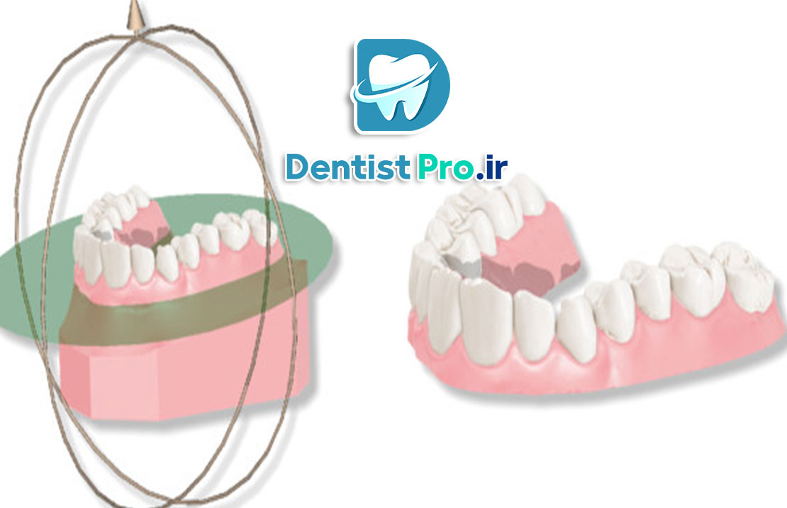 نرم افزار هوشمند آنالیز حرکت فک و دندان: تحول در دندانپزشکی دیجیتال 25 نرم افزار هوشمند آنالیز حرکت فک و دندان: تحول در دندانپزشکی دیجیتال