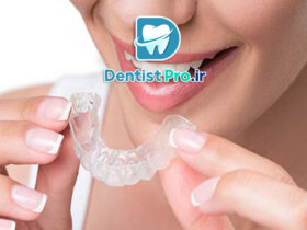 ارتودنسی نامرئی با الگوریتم های تحلیل حرکت دندان: آینده درمان‌های ارتودنسی