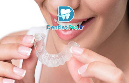 ارتودنسی نامرئی با الگوریتم های تحلیل حرکت دندان: آینده درمان‌های ارتودنسی