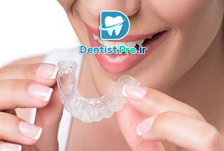 ارتودنسی نامرئی با الگوریتم های تحلیل حرکت دندان: آینده درمان‌های ارتودنسی