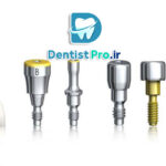 تثبیت فک با پیچ تیتانیومی ضد حساسیت