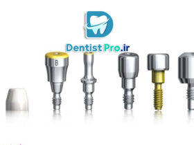 تثبیت فک با پیچ تیتانیومی ضد حساسیت