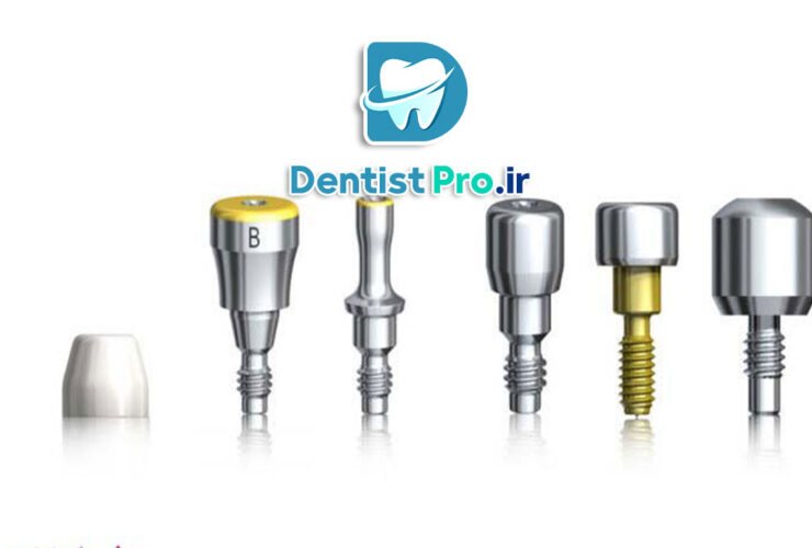 تثبیت فک با پیچ تیتانیومی ضد حساسیت