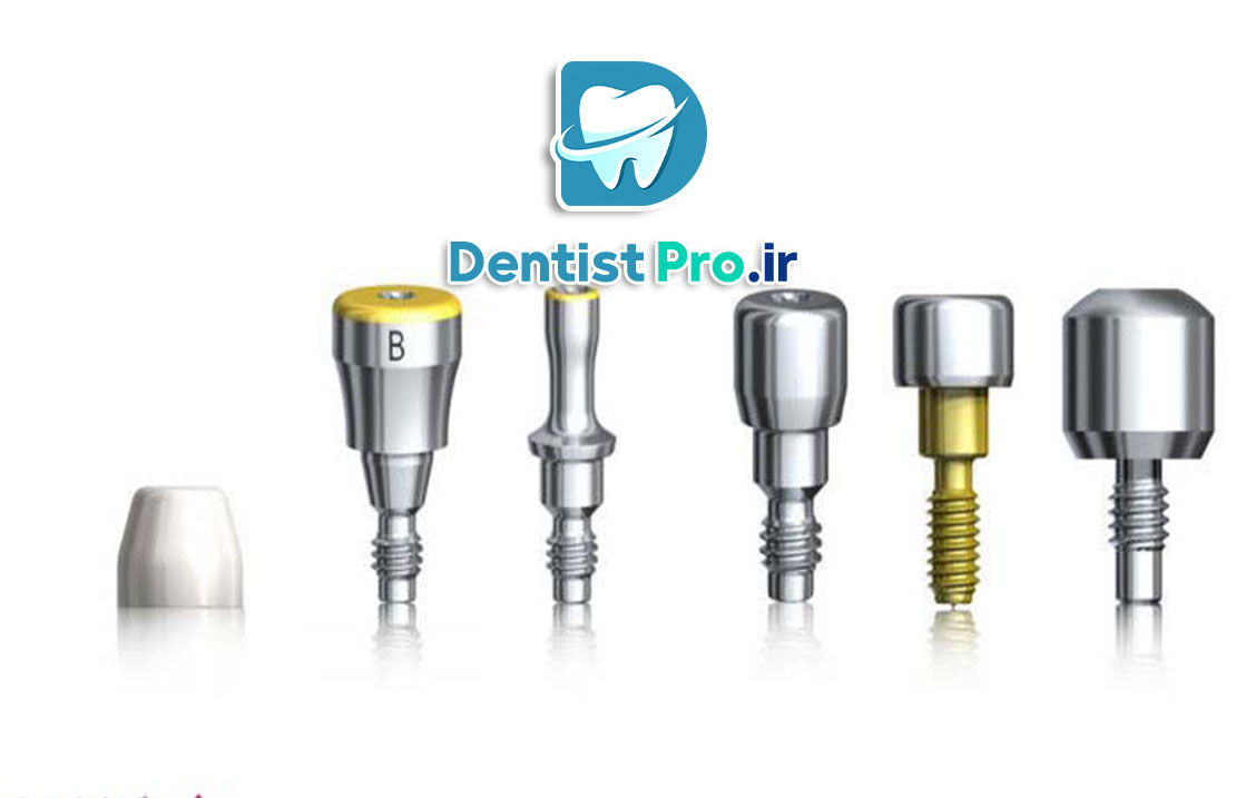 تثبیت فک با پیچ تیتانیومی ضد حساسیت 25 تثبیت فک با پیچ تیتانیومی ضد حساسیت