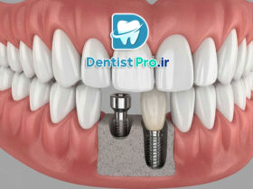 بازسازی بافت نرم فک با فاکتورهای رشد زیستی