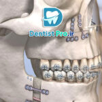 جراحی فک به روش لاپاروسکوپی با رباتیک: انقلاب در جراحی‌های دهان و فک