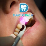 لیزر درمانی لثه ترمیمی: روش نوین و موثر برای سلامت لثه و درمان بیماری‌های پریودنتال