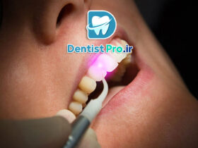 لیزر درمانی لثه ترمیمی: روش نوین و موثر برای سلامت لثه و درمان بیماری‌های پریودنتال