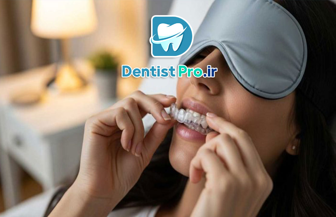 پلاک شبانه محافظ دندان در Bruxism: راهنمای جامع مراقبت و پیشگیری 25 پلاک شبانه محافظ دندان در Bruxism: راهنمای جامع مراقبت و پیشگیری