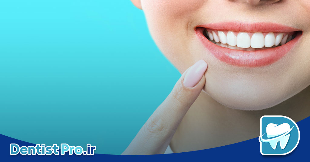 اصلاح غیرجراحی لبخند: راهنمای کامل و تخصصی برای زیبایی طبیعی لبخند شما 26 اصلاح غیرجراحی لبخند: راهنمای کامل و تخصصی برای زیبایی طبیعی لبخند شما