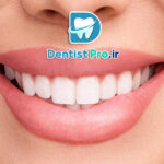 اصلاح غیرجراحی لبخند: راهنمای کامل و تخصصی برای زیبایی طبیعی لبخند شما