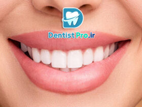 اصلاح غیرجراحی لبخند: راهنمای کامل و تخصصی برای زیبایی طبیعی لبخند شما