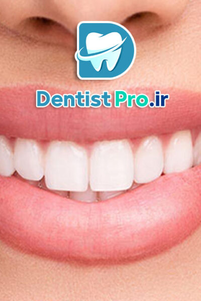 اصلاح غیرجراحی لبخند: راهنمای کامل و تخصصی برای زیبایی طبیعی لبخند شما