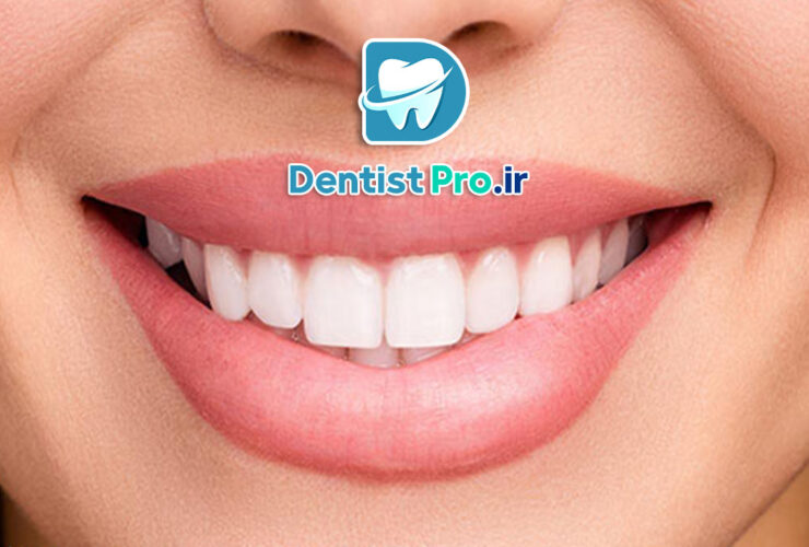 اصلاح غیرجراحی لبخند: راهنمای کامل و تخصصی برای زیبایی طبیعی لبخند شما