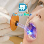 لیزر تراپی بدون درد در دندانپزشکی کودکان: تحولی نوین در درمان‌های دندانی کودکان