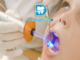 لیزر تراپی بدون درد در دندانپزشکی کودکان: تحولی نوین در درمان‌های دندانی کودکان