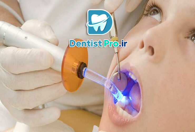 لیزر تراپی بدون درد در دندانپزشکی کودکان: تحولی نوین در درمانهای دندانی کودکان 31 لیزر تراپی بدون درد در دندانپزشکی کودکان: تحولی نوین در درمانهای دندانی کودکان