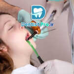 درمان ترمیمی بی درد با سیستم های ایزوژل کودکان: راهکاری نوین برای مراقبت از دندان‌های کودکان