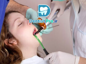 درمان ترمیمی بی درد با سیستم های ایزوژل کودکان: راهکاری نوین برای مراقبت از دندان‌های کودکان