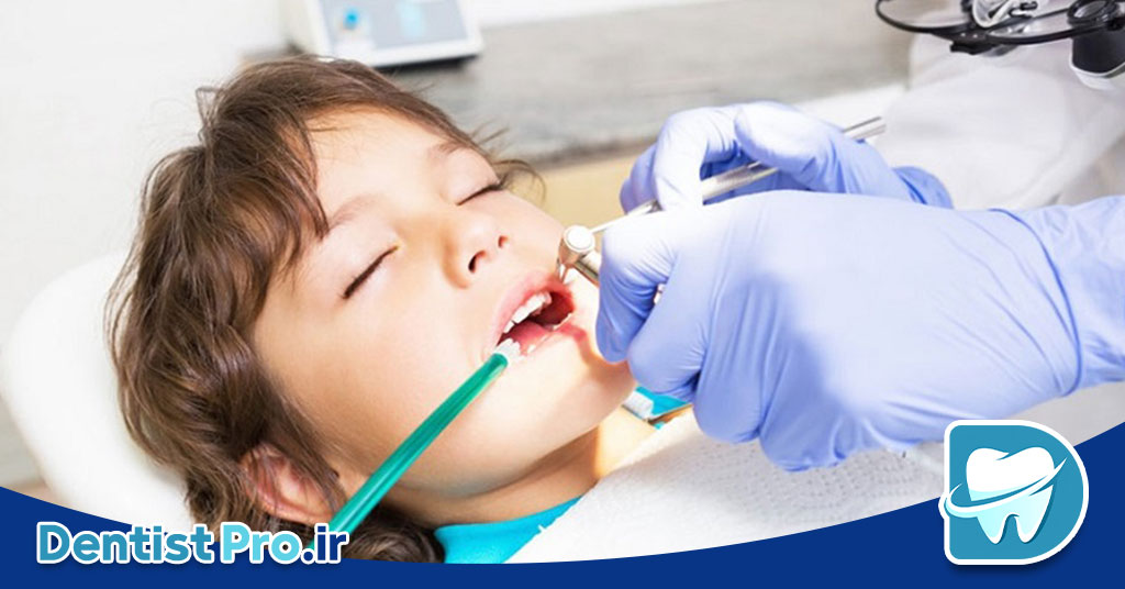 درمان ترمیمی بی درد با سیستم های ایزوژل کودکان: راهکاری نوین برای مراقبت از دندانهای کودکان 26 درمان ترمیمی بی درد با سیستم های ایزوژل کودکان: راهکاری نوین برای مراقبت از دندانهای کودکان