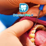 جراحی لثه پلاستیک با هدف زیبایی لبخند